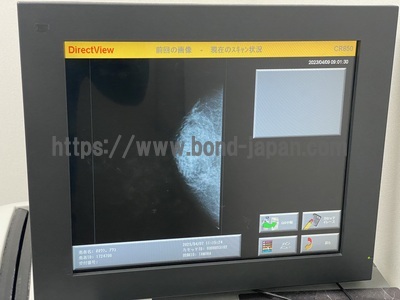 Mammography | HOLOGIC | Lorad M-IV