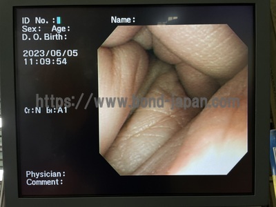 Video Gastroscope | OLYMPUS | GIF-XP260NS