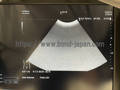 超音波診断装置 | 日立製作所 | ARIETTA 60の写真