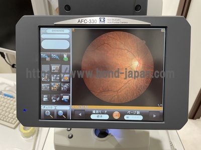 Fundus Camera | NIDEK | AFC-330