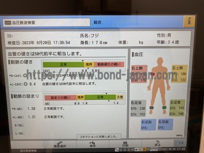 血圧脈波検査装置 | フクダ電子株式会社 | バセラ　VS-2000の写真