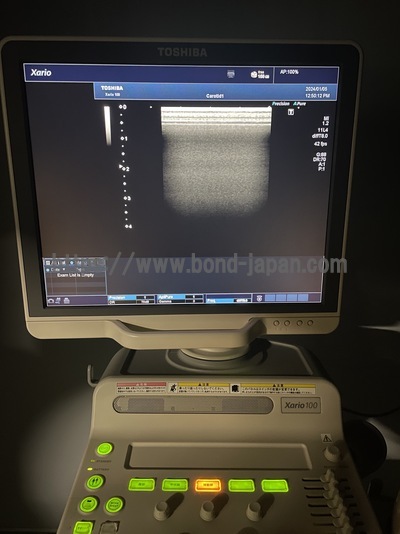 Color Doppler | CANON | TUS-X100 Xario 100