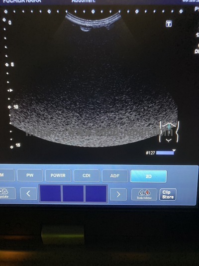 Color Doppler | CANON | Viamo SSA-640A