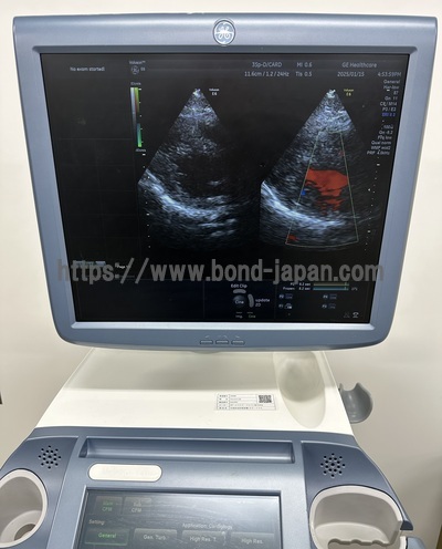 4D Ultrasound | GE | Voluson E6