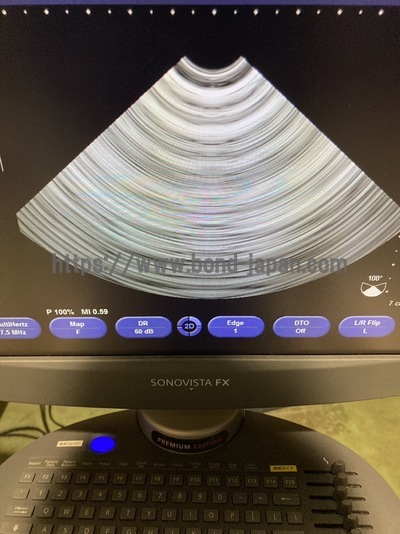  | SIEMENS | Sonovista FX PE