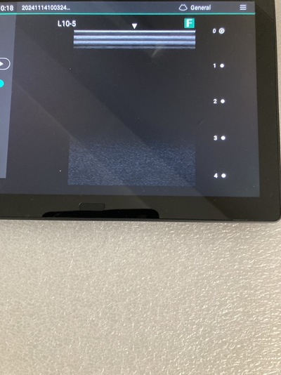 ワイヤレス超音波画像診断装置&nbsp;|&nbsp;富士フイルムメディカル株式会社&nbsp;|&nbsp;iViz air Linearの写真