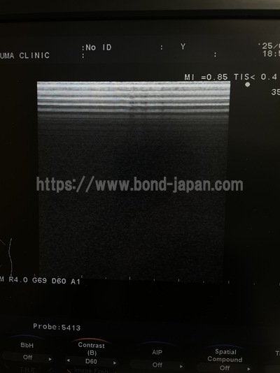 Color Doppler | HITACHI | F37