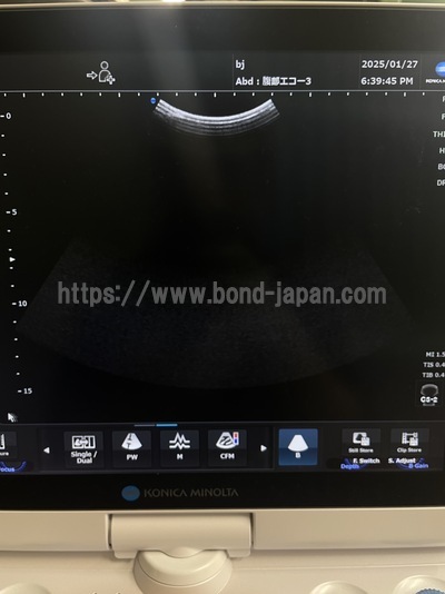 Ultrasound | konica | SONIMAGE HS1