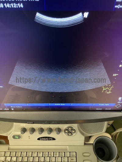 Color Doppler | GE | LOGIQ P5