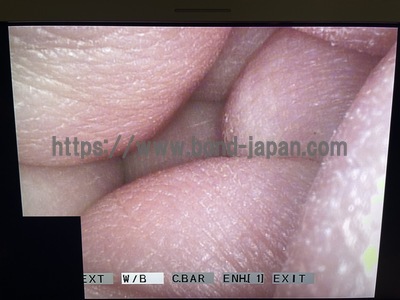 Video Rhinolaryngoscope | OLYMPUS | ENF-VQ