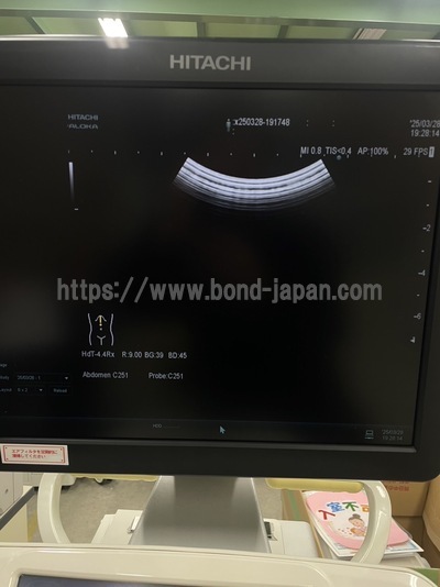 Ultrasound System | HITACHI | ARIETTA 60