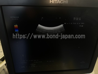 Color Doppler | HITACHI | F37