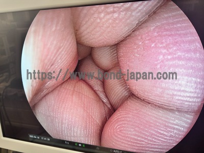 Endoscope System | FUJIFILM | EPX-4450 Advancia