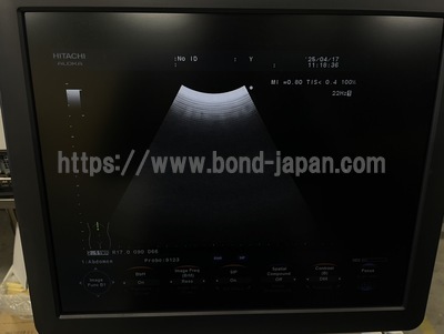 Color Doppler | HITACHI | F37