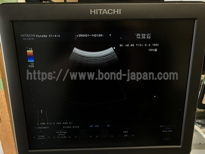 Color Doppler | HITACHI | F37