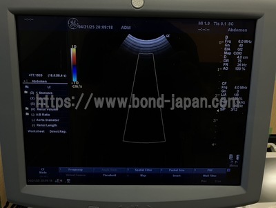 Color Doppler | GE | LOGIQ P5