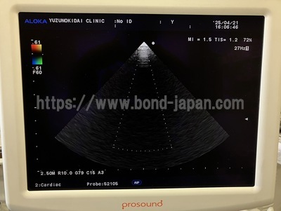 Ultrasound System | HITACHI | Prosound α7