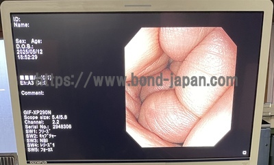 Endoscopy System | OLYMPUS | LUCERA ELITE CV-290
