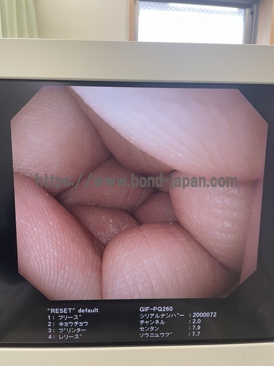 Video Gastroscope | OLYMPUS | GIF-PQ260