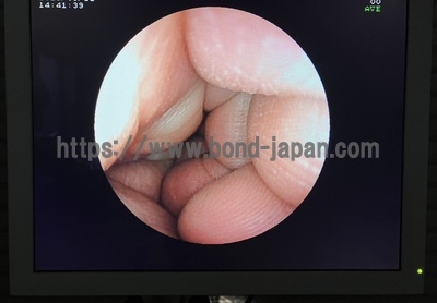 Endoscopy System | FUJIFILM | EPX-3000