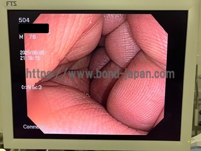 Endoscopy System | OLYMPUS | CV-150