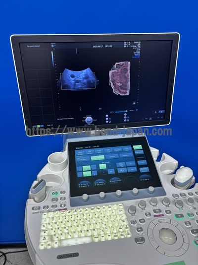 4D Ultrasound | GE | Voluson E8 BT15