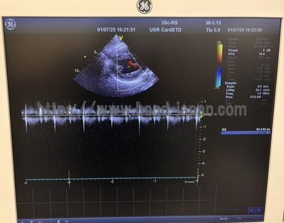 Ultrasound | GE | Vivid T8
