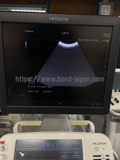 超音波診断装置 | 日立製作所 | ARIETTA 60の写真
