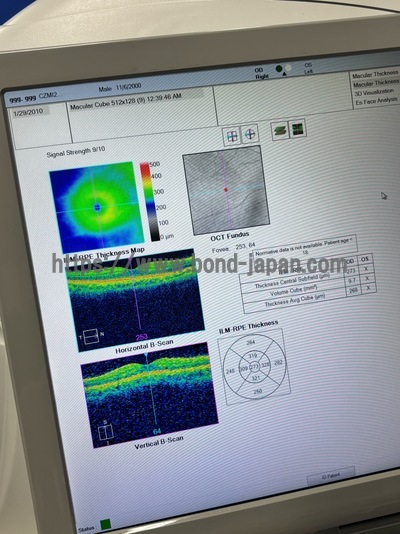 ** Great Conditioned OCT** | Carl Zeiss | Cirrus 500 HD-OCT Plus