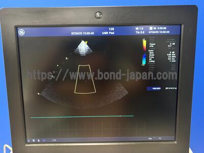 Ultrasound | GE | Vivid E9