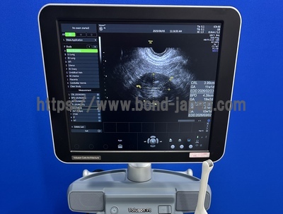 4D Ultrasound | GE | Voluson P8 BT16