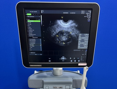 4D Ultrasound&nbsp;|&nbsp;GE&nbsp;|&nbsp;Voluson P8 BT16