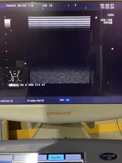 Color Doppler&nbsp;|&nbsp;HITACHI&nbsp;|&nbsp;Prosound α6