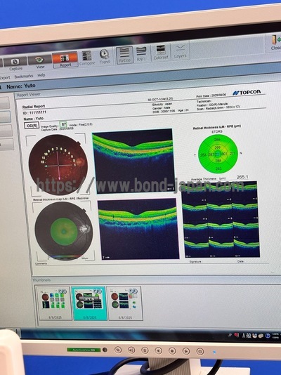 OCT with Non-mydriatic retinal camera | TOPCON | 3D OCT 1 / Maestro 1