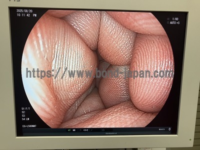 Endoscope System | FUJIFILM | LASEREO 4450HD