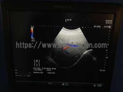 Ultrasound System | HITACHI | ARIETTA 60
