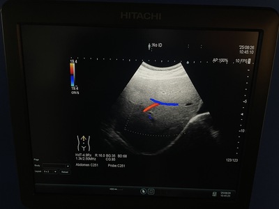 Ultrasound System&nbsp;|&nbsp;HITACHI&nbsp;|&nbsp;ARIETTA 60