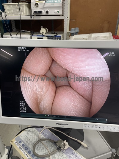 Endoscopy System | FUJIFILM | EPX-4450HD