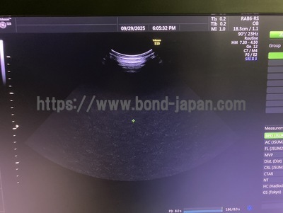 4D Ultrasound | GE | Voluson S10 BT16