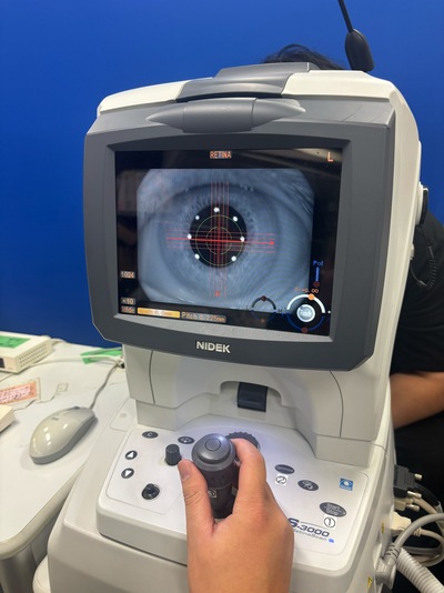 Retinal Camera and OCT Combined&nbsp;|&nbsp;NIDEK&nbsp;|&nbsp;RS-3000