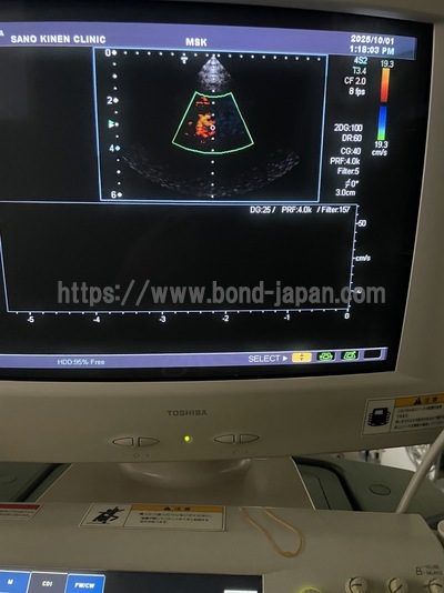 Ultrasound Color Doppler | CANON | SSA-700A Aplio50