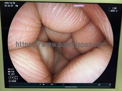 Endoscopy System | FUJIFILM | EPX-4450HD