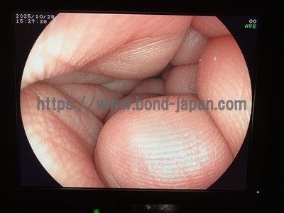 Video Gastroscope | FUJIFILM | EG-3000FP