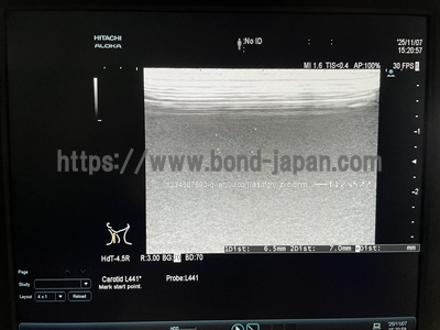 Ultrasound System | HITACHI | ARIETTA 60
