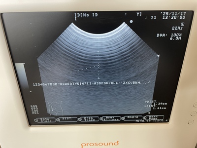 Ultrasound | HITACHI | Prosound 2