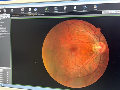 A Combination system of OCT and fundus camera&nbsp;|&nbsp;NIDEK&nbsp;|&nbsp;RS-330 Retina Scan Duo
