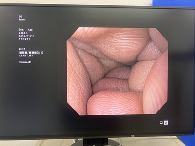 Video Gastroscope&nbsp;|&nbsp;OLYMPUS&nbsp;|&nbsp;GIF-Q150X