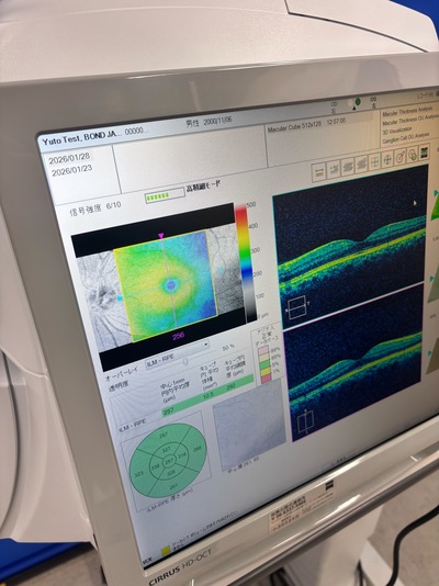 OCT&nbsp;|&nbsp;Carl Zeiss&nbsp;|&nbsp;Cirrus 500 HD-OCT Plus