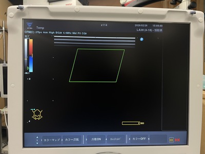 &nbsp;|&nbsp;FUKUDA DENSHI&nbsp;|&nbsp;UF-760AG+
