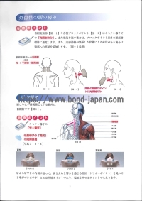 キセノン治療器 | 株式会社日本医広 | Auveの写真